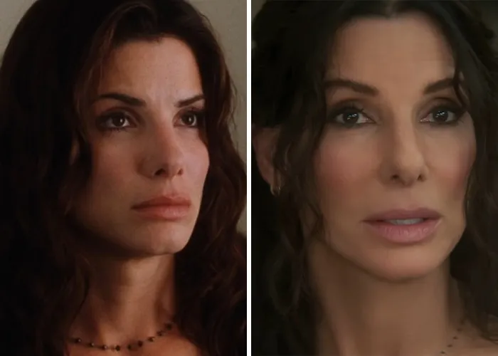 Nicole Kidman and Sandra Bullock side-by-side, demonstrating Hollywood's plastic surgery obsession.