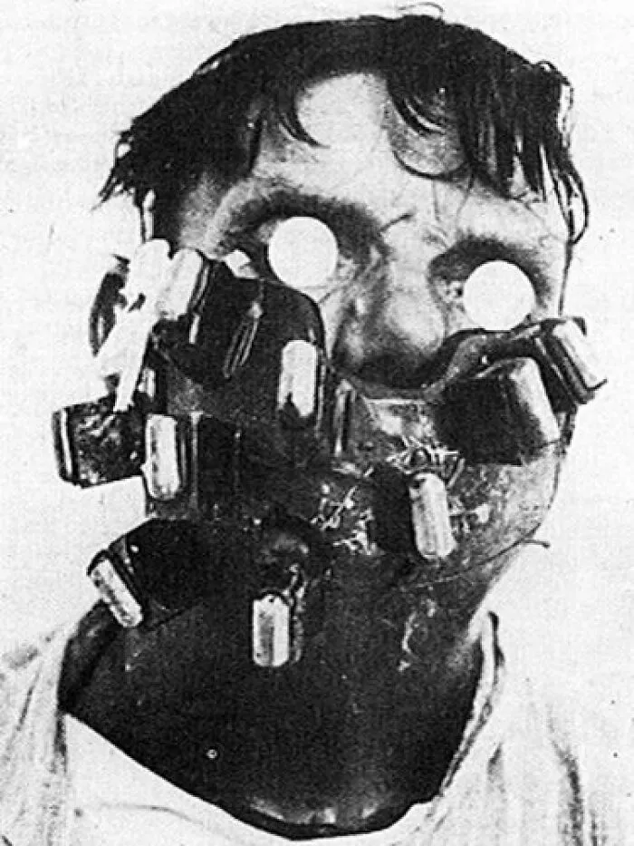 A black and white photo of a patient wearing an old face mask from medical history