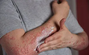 "I Couldn't Breathe": 86 Stories From People Who Survived The Worst Illnesses Imaginable