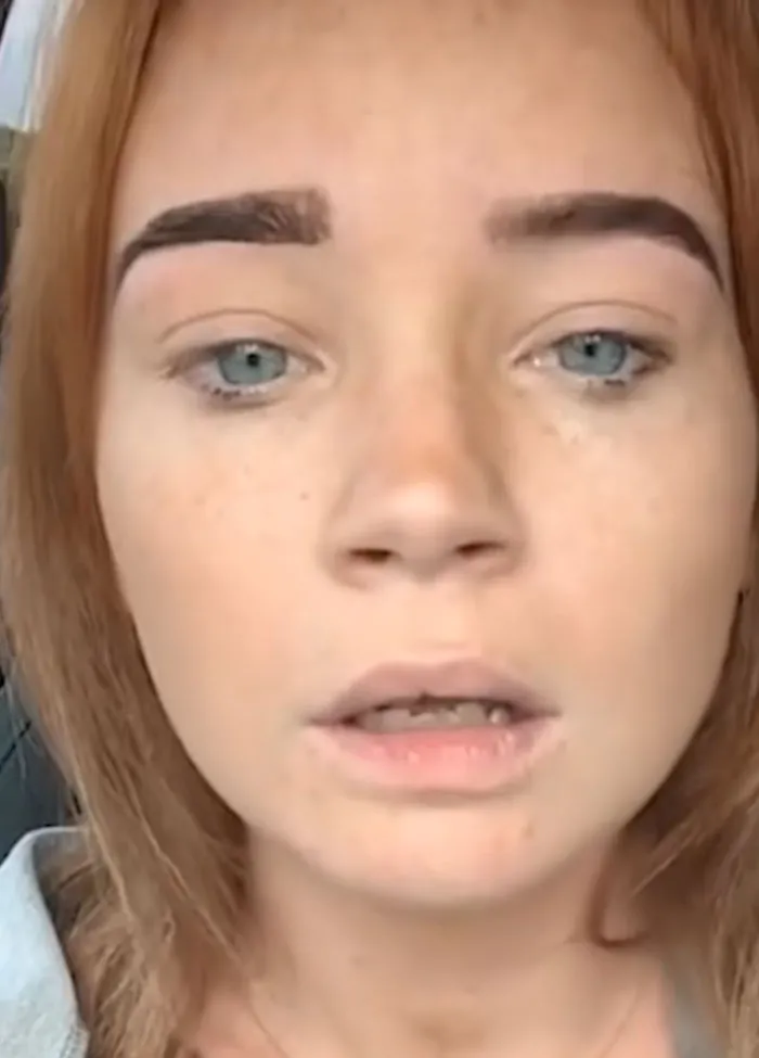 A close-up of poorly shaped uneven eyebrows representing beauty procedures fails