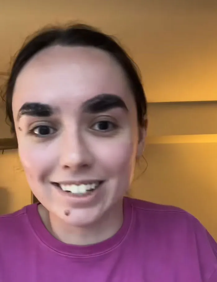 A woman smiling with extremely thick, dark, and uneven eyebrows showing beauty procedures fails