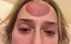 64 People Share The Beauty Procedures They Wish They Could Take Back