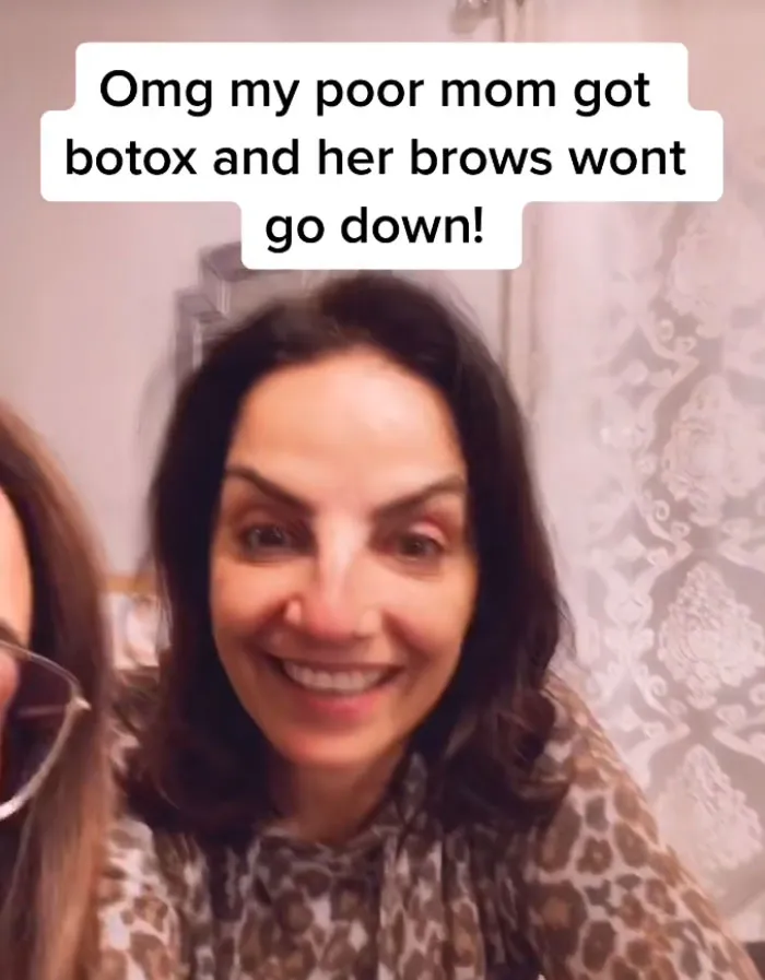 A woman with frozen highly arched eyebrows showing botox beauty procedures fails.