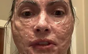 64 People Share The Beauty Procedures They Wish They Could Take Back