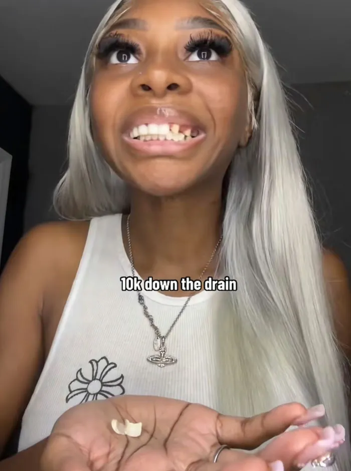A woman showing a broken tooth veneer in her hand, representing costly beauty procedures fails