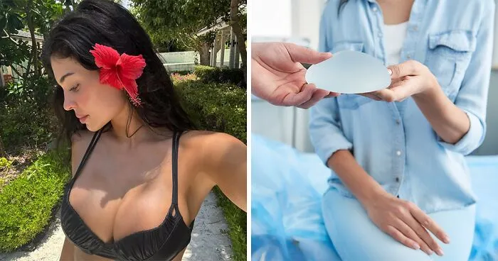 New Study Reveals The 'Perfect' Breast Shape, And It's Not The Size Most Plastic Surgeons Push For