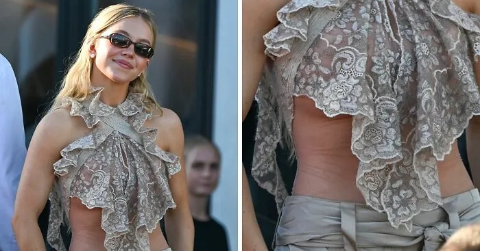 Sydney Sweeney's Latest Photos Have Netizens Zooming In On Mysterious Marks On Her Rib And Stomach