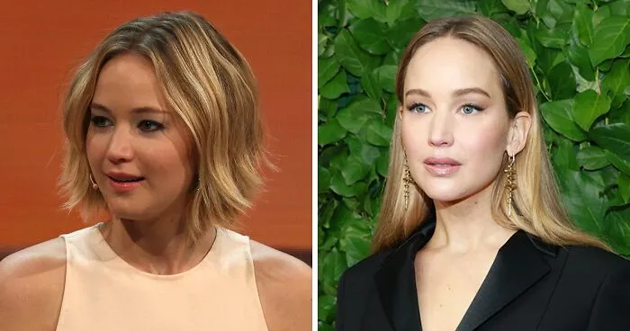 Jennifer Lawrence's Plastic Surgery Confession Draws Backlash As Photoshoot Sparks Fresh Scrutiny