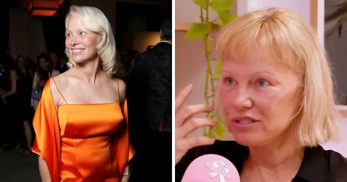 "Around 10 Years To Live": Pamela Anderson Reveals Details Of Her Harrowing Health Battle