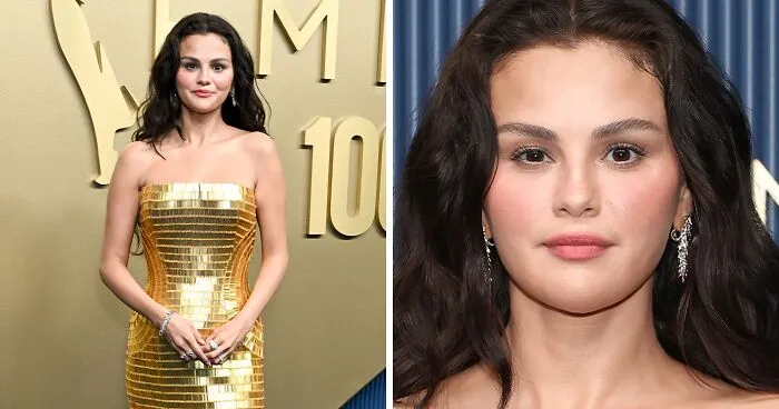 Doctor Weighs In After Selena Gomez's "Unrecognizable" Emmys Appearance Had Fans Begging Her To Lay Off The Botox
