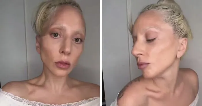 Lady Gaga's Latest Video Draws Brutal Comparisons To Ariana Grande Amid Concerns Over Her Appearance