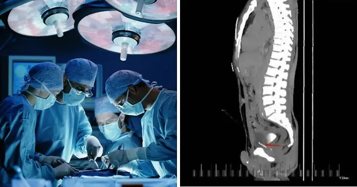 Doctors Make Damning Discovery Of 'Foreign Bodies' In Man's Chest, Pelvis, Bladder And Private Parts At Chinese Hospital
