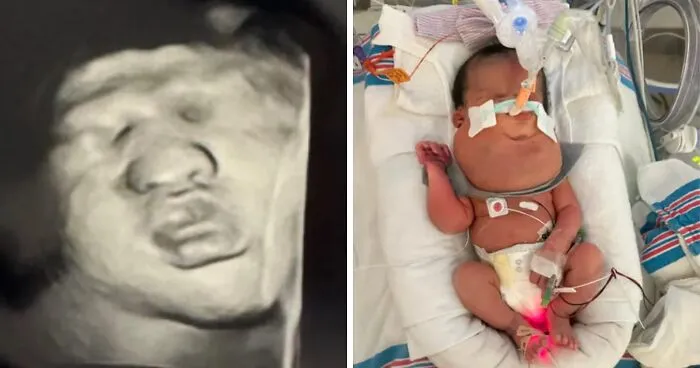 Pregnant Woman Goes For Routine Scan, Then Hears A Terrifying Two-Word Diagnosis