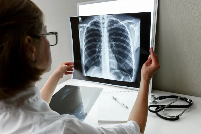A doctor examines a chest X-ray on a light board, suggesting unsettling and creepy things hidden from view.