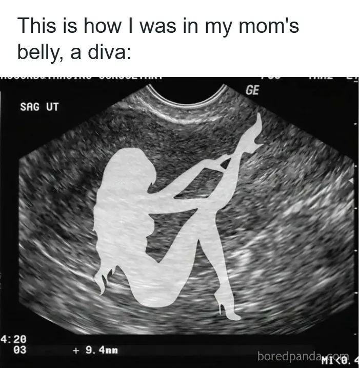 A funny ultrasound image of a diva silhouette representing funny memes about being a woman