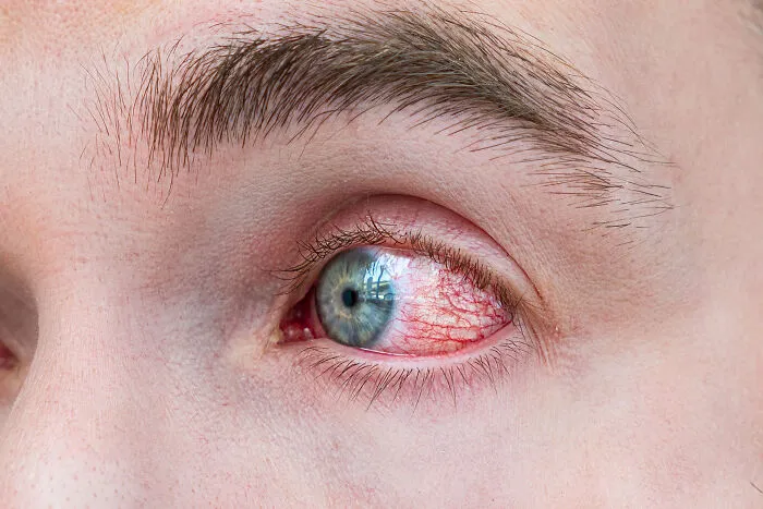 "I Couldn't Breathe": 86 Stories From People Who Survived The Worst Illnesses Imaginable
