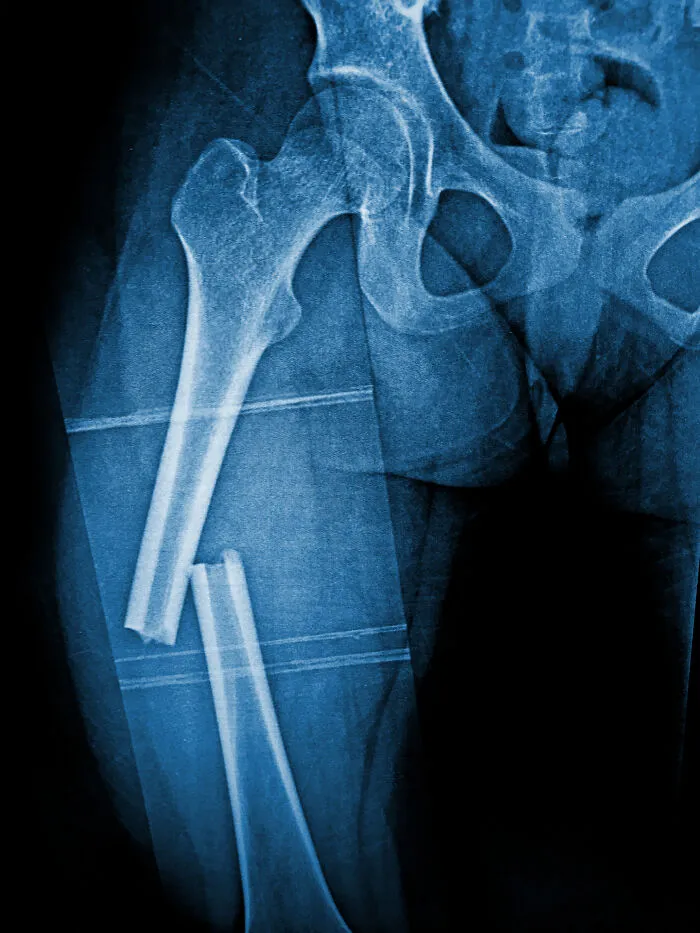 46 Times Patients Reacted To Pain In Ways Medical Professionals Never Saw Coming