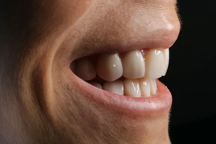 A close-up of a person's mouth with a bright smile, an 'ick' related to men.