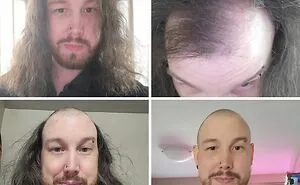 69 Side-By-Side Comparisons Showing Things And People Changing Drastically
