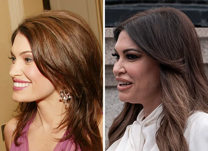 Before and after images of Trump's circle women displaying MAGA face changes