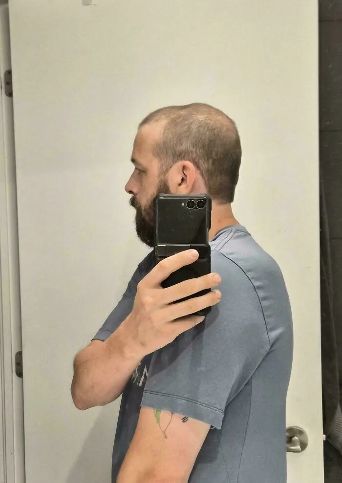 A man showing a bad haircut with an uneven patch on his head, illustrating when things went wrong