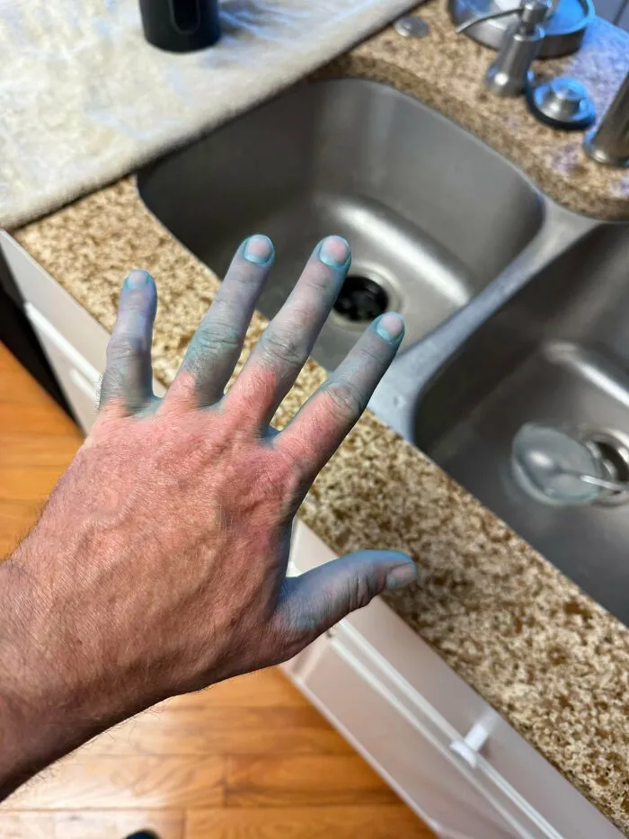 A hand stained with blue dye over a kitchen sink, showing when things went wrong during a task