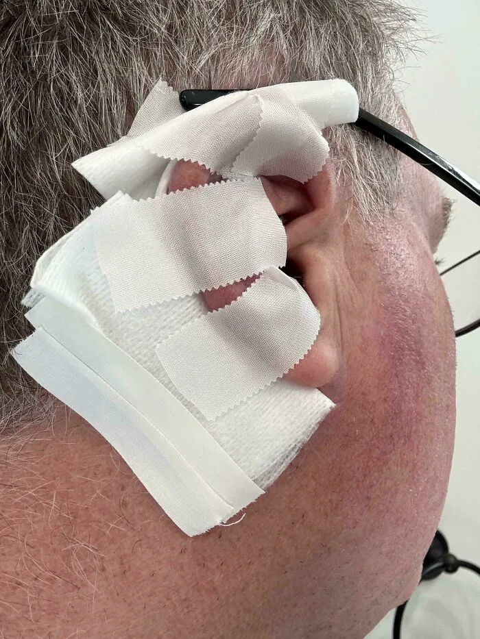Man wearing glasses with ear bandage as things went wrong pics