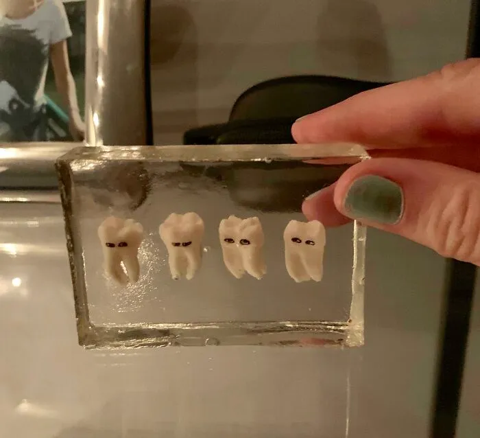 Four wisdom teeth preserved inside a clear resin block, a quirky DIY project idea.