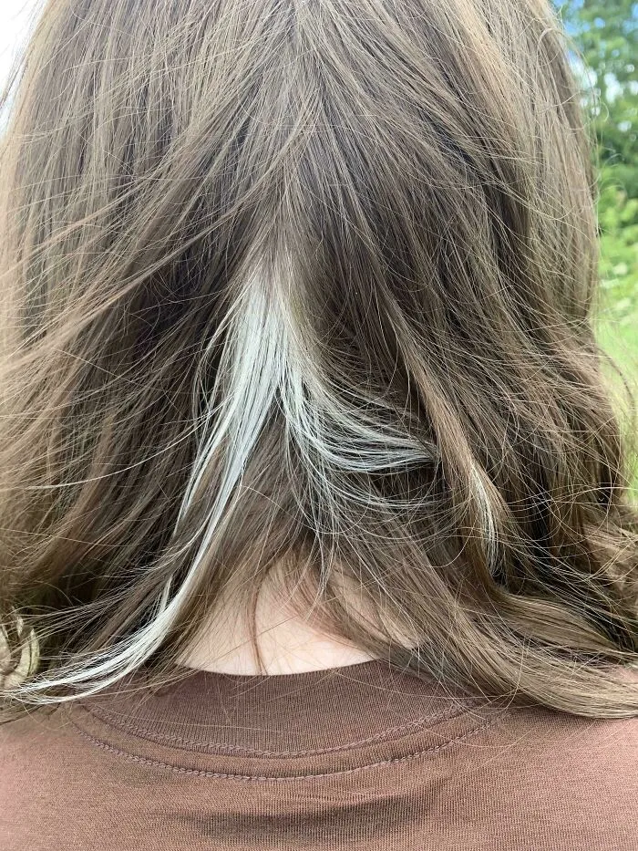Back of head view showing a natural white hair patch, an interesting human anatomy trait