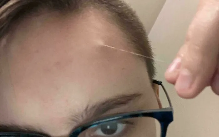 Close-up of a unusually long single white forehead hair, showing unique human anatomy features