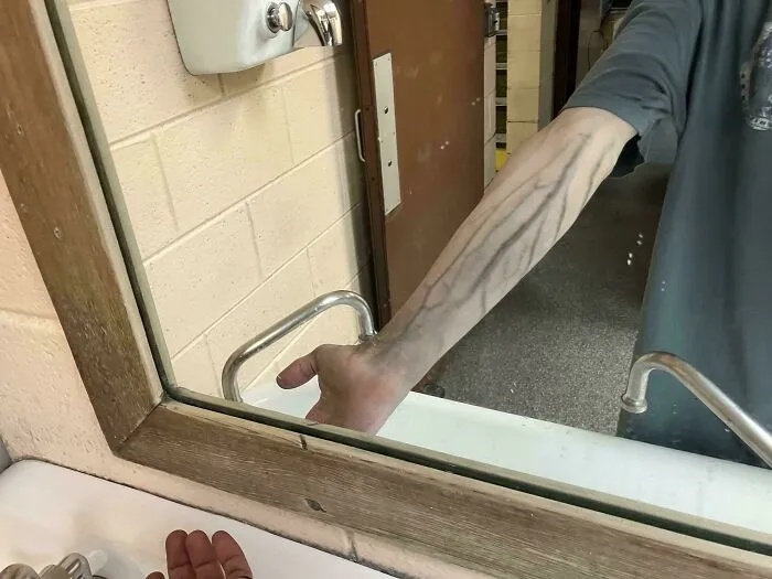 Reflection in a mirror showing dark visible veins in human anatomy