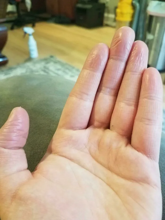 Close-up of human anatomy showcasing unique body features on a wrinkly hand after bath time.