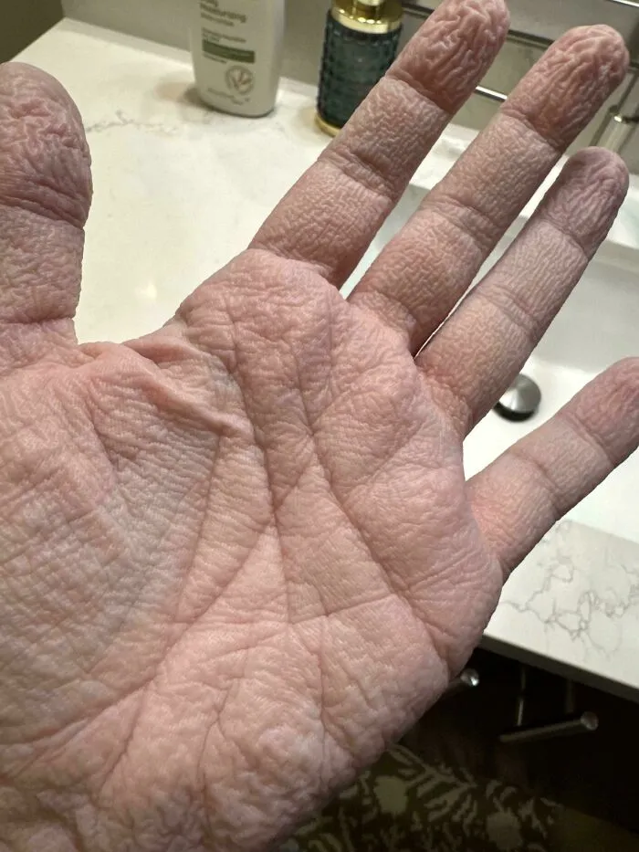 Extremely wrinkly hand showing unique human anatomy features after long exposure to water