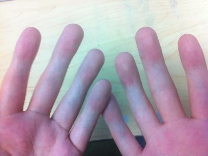 A human anatomy feature showing hands with unusual long fingers.