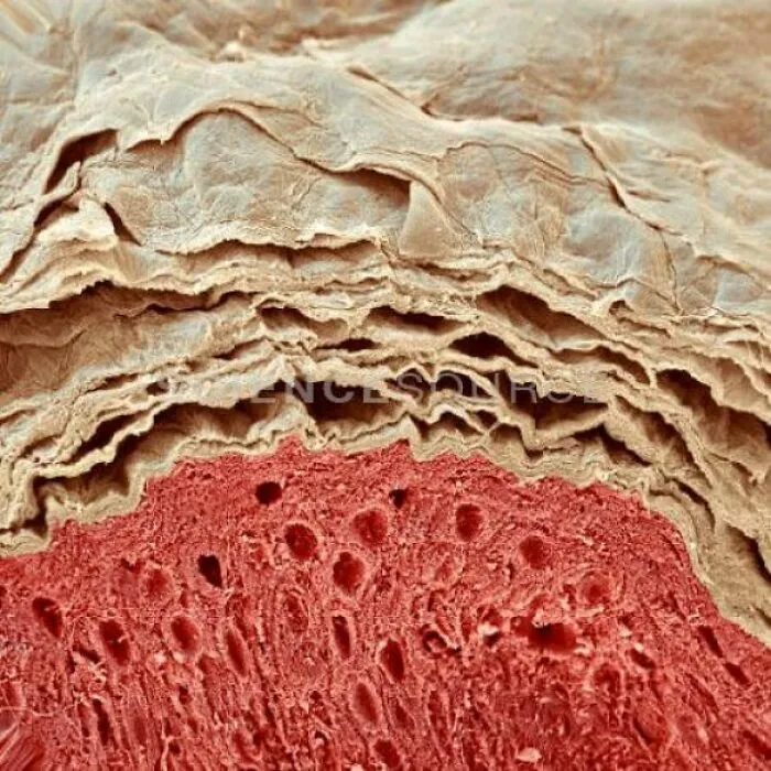 Microscopic close-up view showing the layered skin structure and red tissue of human anatomy.