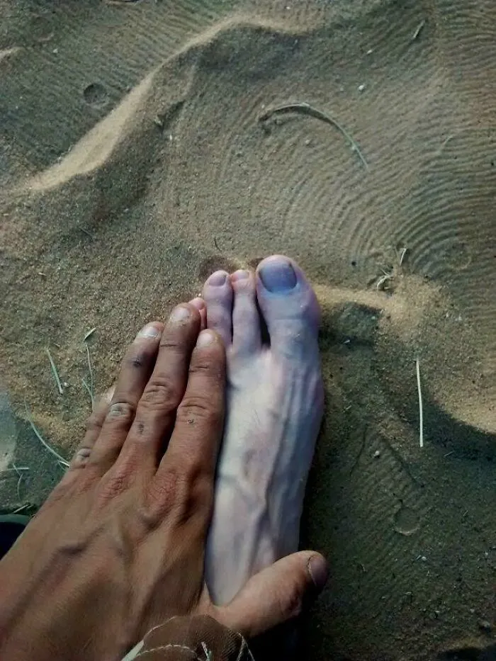 A pale foot resting on sandy ground showcasing unique human anatomy features next to a hand