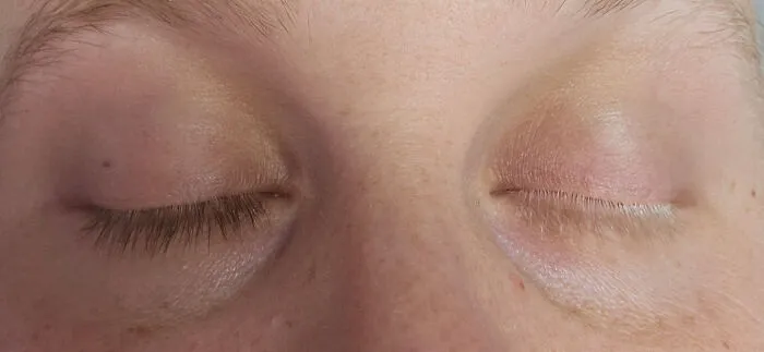 Close-up of human anatomy showing eyelashes with two different hair colors on closed eyes.