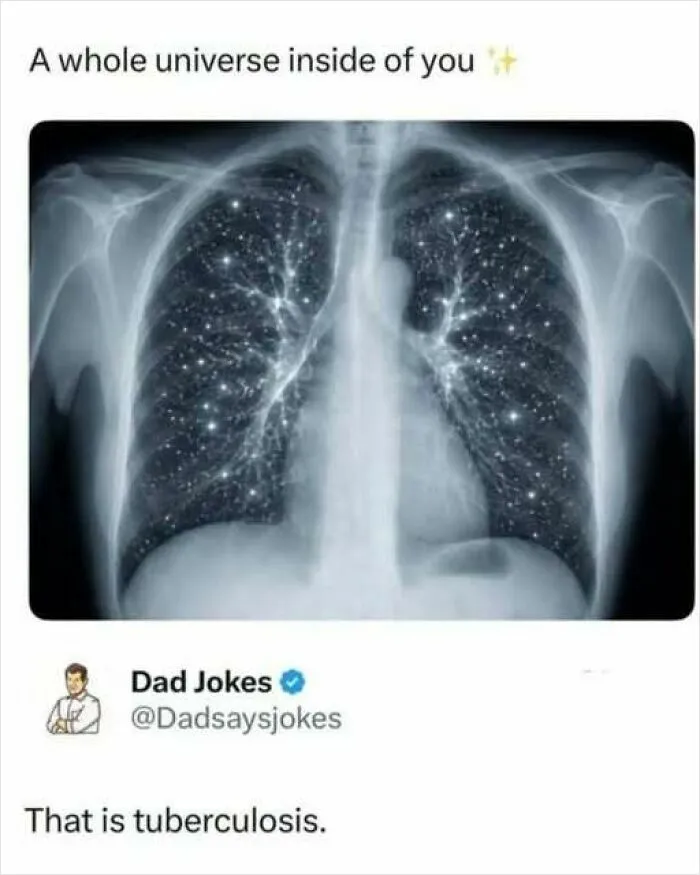 X-ray image meme showing starry lungs in a gallery of odd and interesting photos