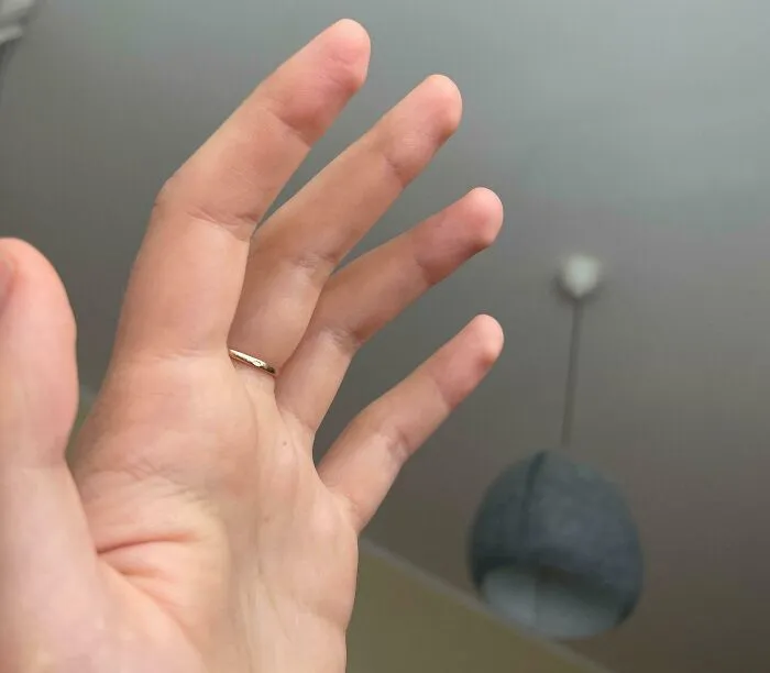 Close-up of human anatomy showing a hand with a thin gold ring