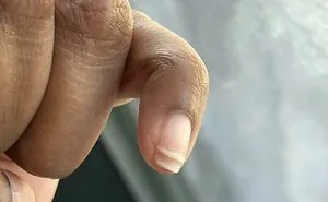 66 Stupefying Photos Of The Human Body That You May Not Have Seen Before