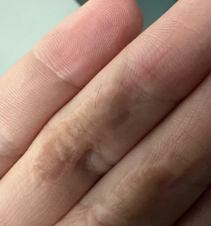 Extreme close-up of human anatomy showing hair growing on finger body features.