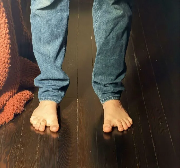 Person standing on wooden floor showing bare feet with unusually wide gaps between toes, demonstrating human anatomy.