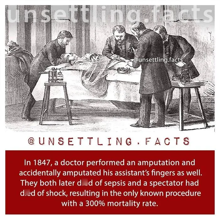 Unsettling facts: 19th-century illustration of a doctor performing a surgical amputation