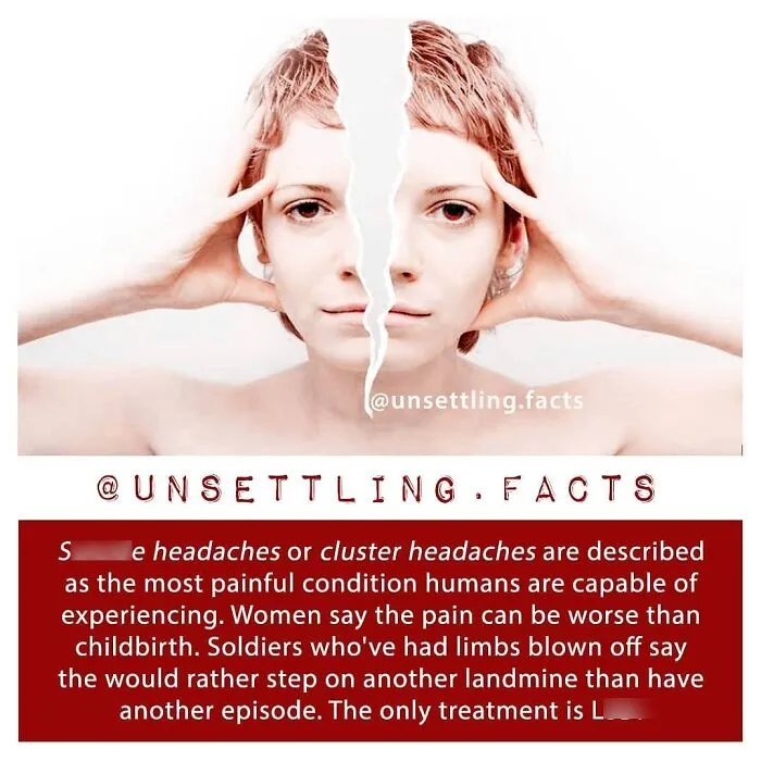 A portrait of a woman with her face torn down the middle, illustrating unsettling facts about severe headaches.