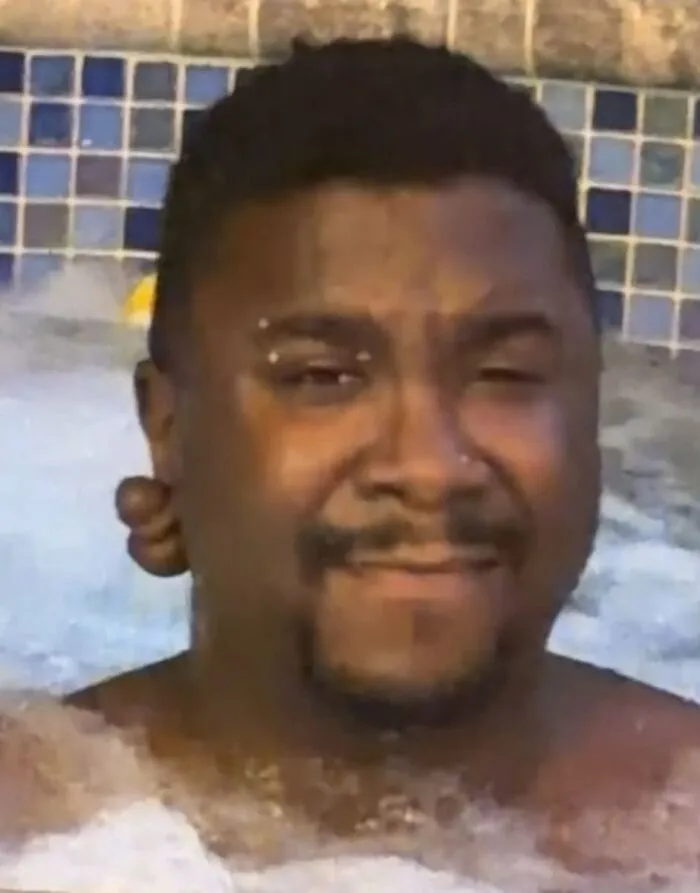 A man relaxing in a hot tub, part of disturbing medical photos showing a keloid on his earlobe.