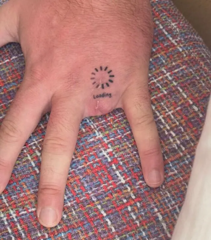 Medical photos of a hand with missing fingers and a loading tattoo on the skin