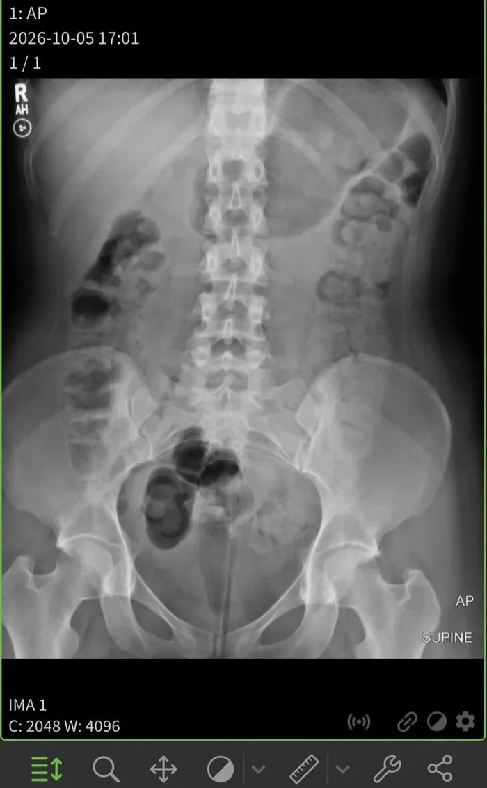 Pelvic and abdominal x-ray scan showing internal bones from medical photos series