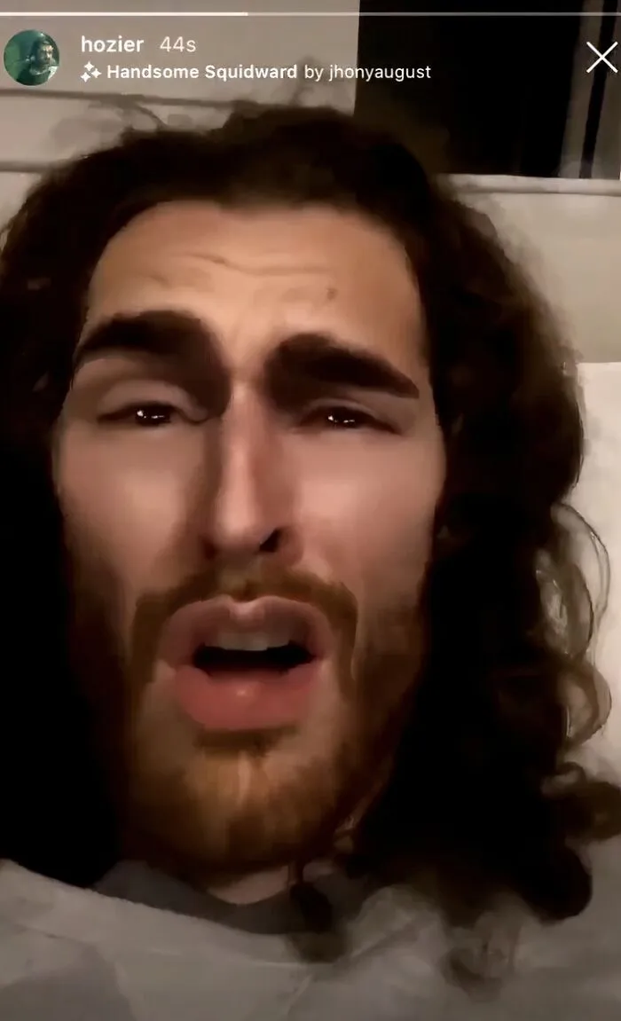 Hozier uses a face filter in a video selfie, illustrating celebrity social media fails.