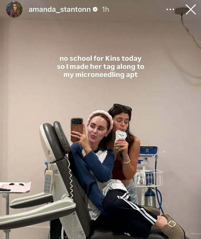 Two women at a microneedling appointment with one taking a selfie for influencer content