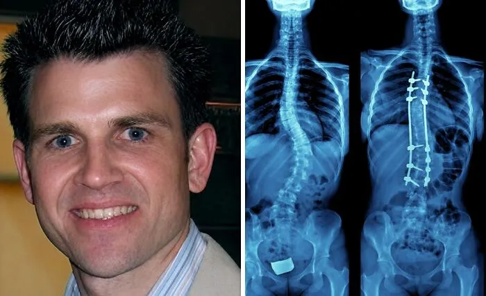 From 2011–2013, Dr. Christopher Duntsch Paralyzed Or Ended 33 Of His 38 Patients During Routine Spinal Surgery